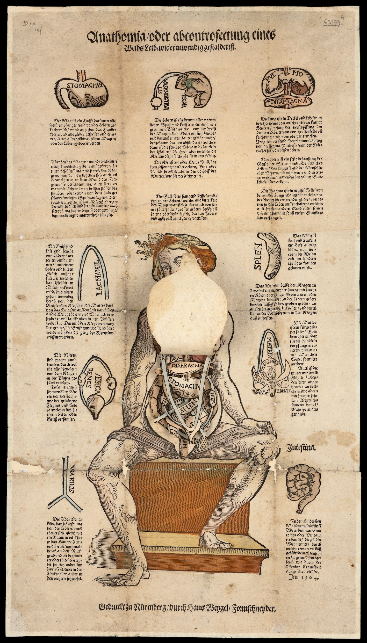 "Anatomical fugitive sheet."