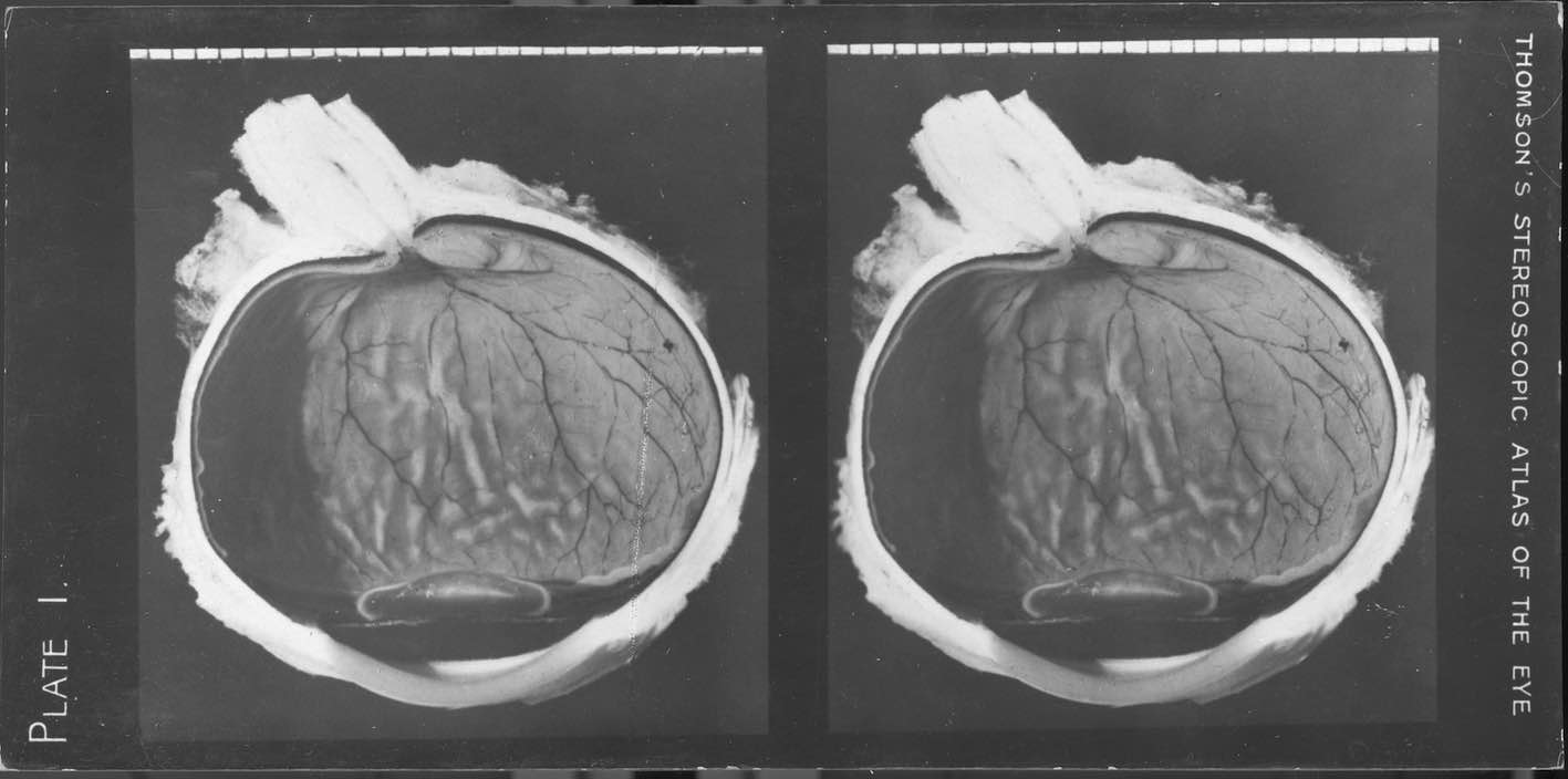"The anatomy of the human eye, plate 1."