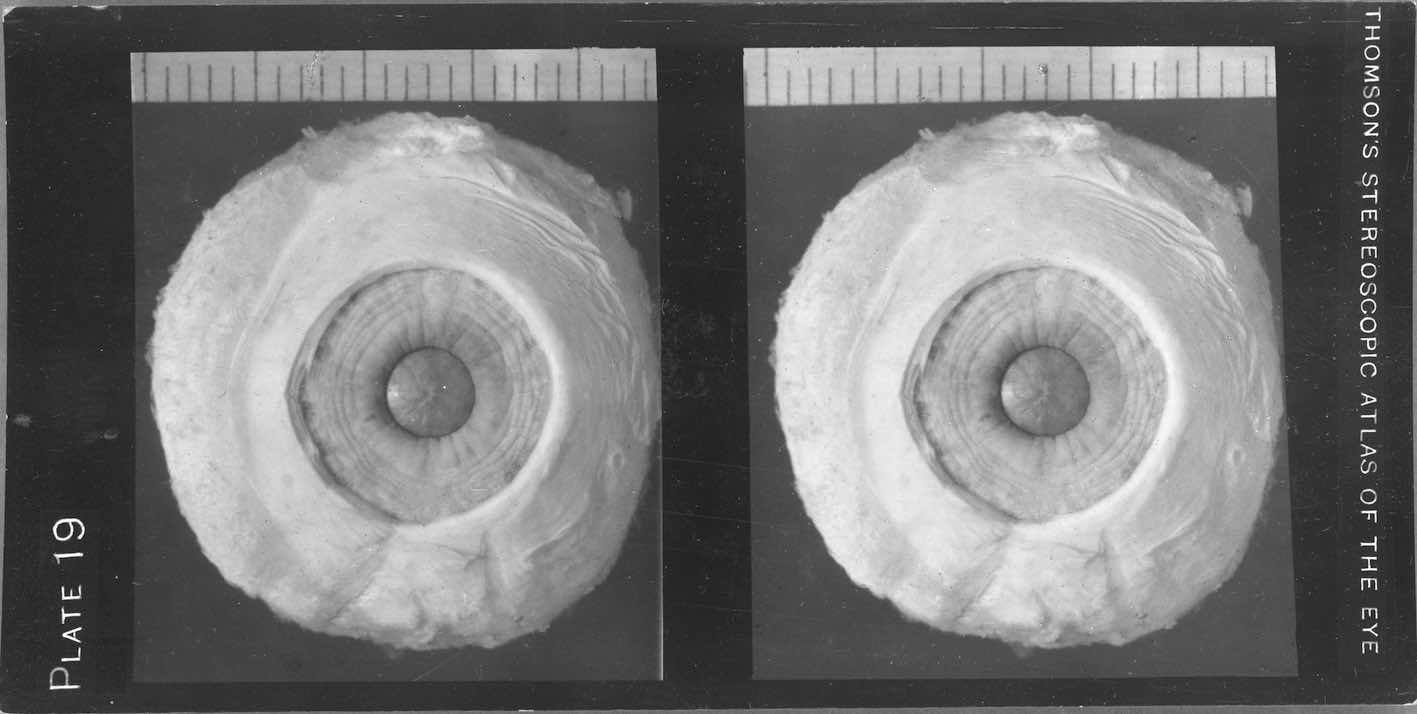 "The anatomy of the human eye, plate 19."