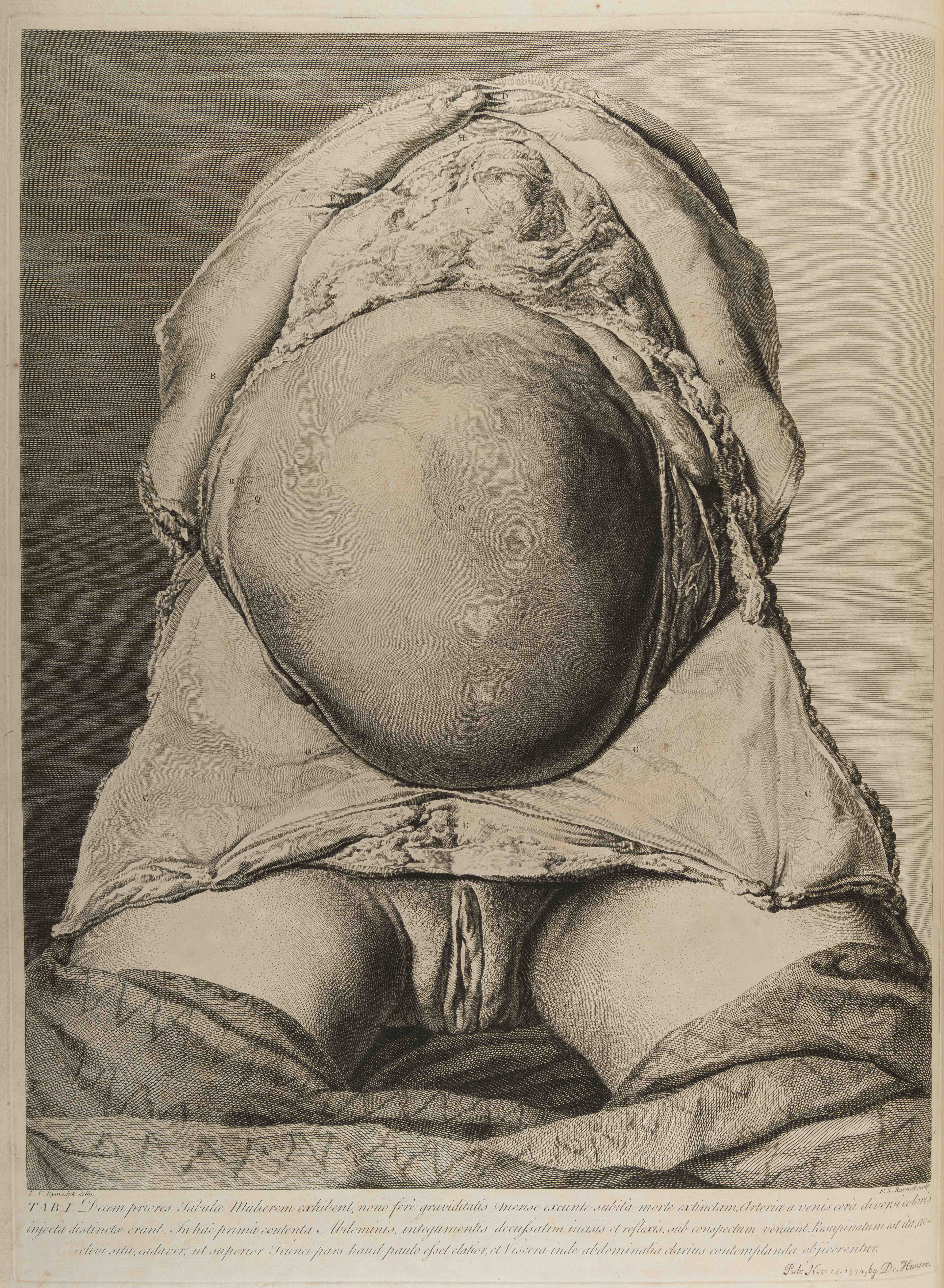 "Table 1 of William Hunter, Anatomia Uteri Humani Gravidi Tabulis Illustrata (Birmingham: John Baskerville, 1774), University of St Andrews Library, rfx QM421.H8."