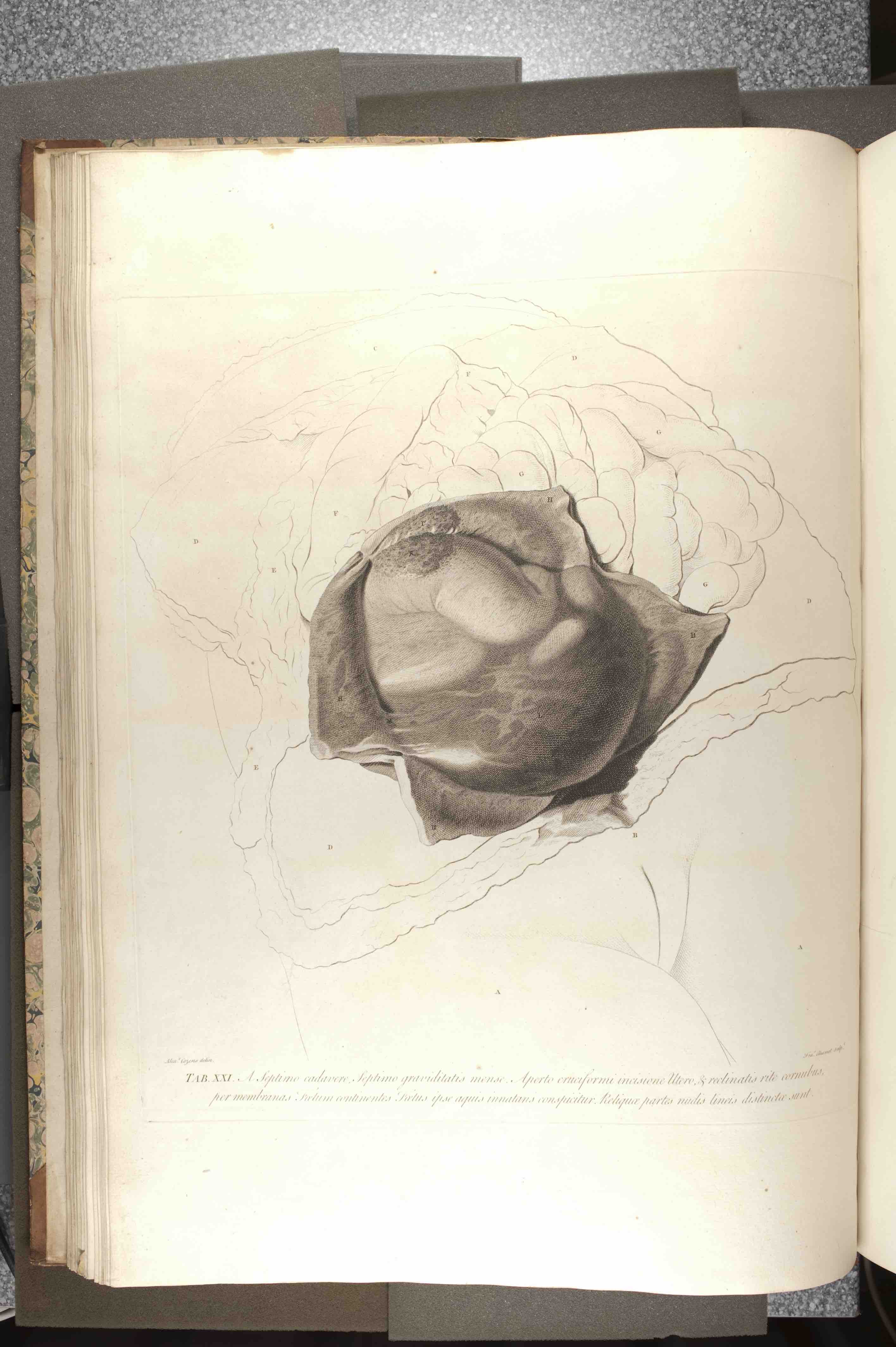 "Table 21 of William Hunter, Anatomia Uteri Humani Gravidi Tabulis Illustrata (Birmingham: John Baskerville, 1774), University of St Andrews Library, rfx QM421.H8."