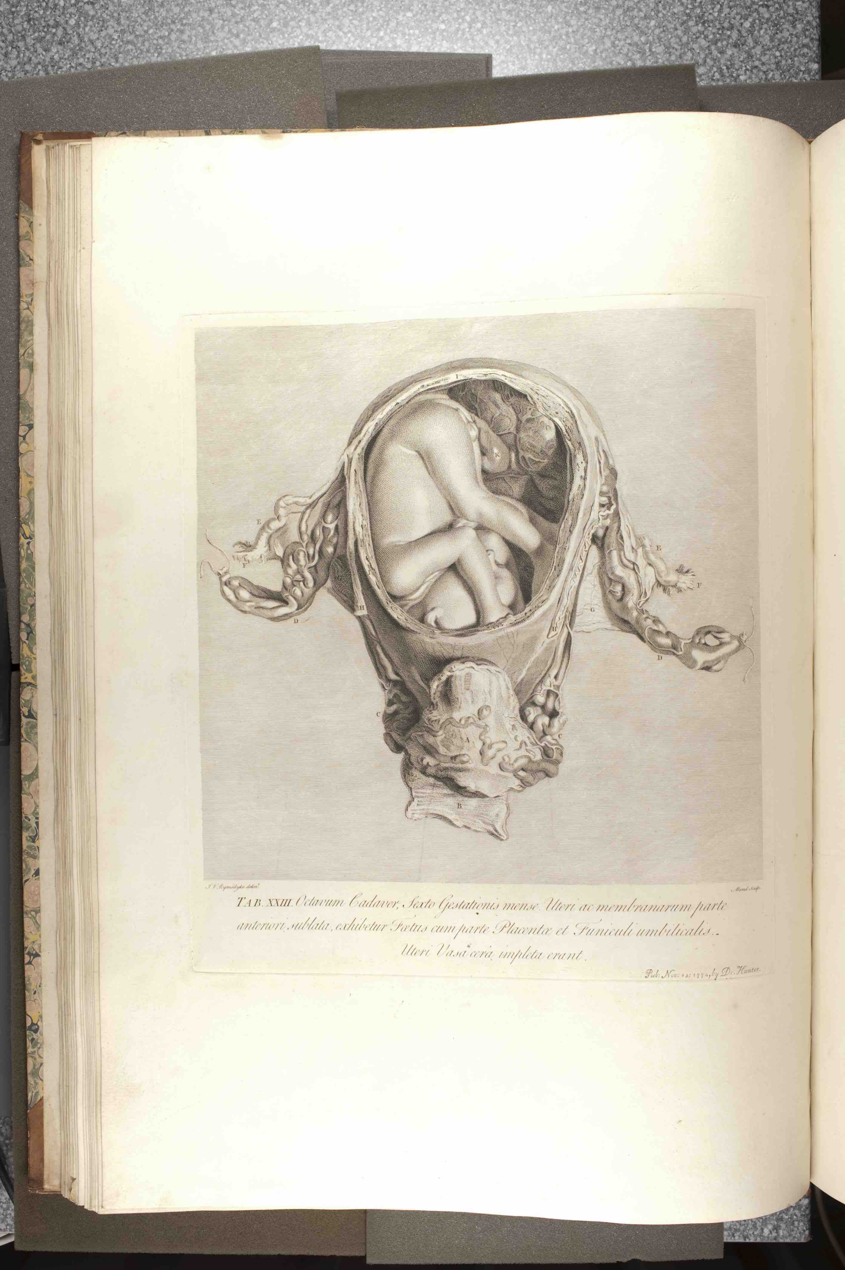 "Table 23 of William Hunter, Anatomia Uteri Humani Gravidi Tabulis Illustrata (Birmingham: John Baskerville, 1774), University of St Andrews Library, rfx QM421.H8."