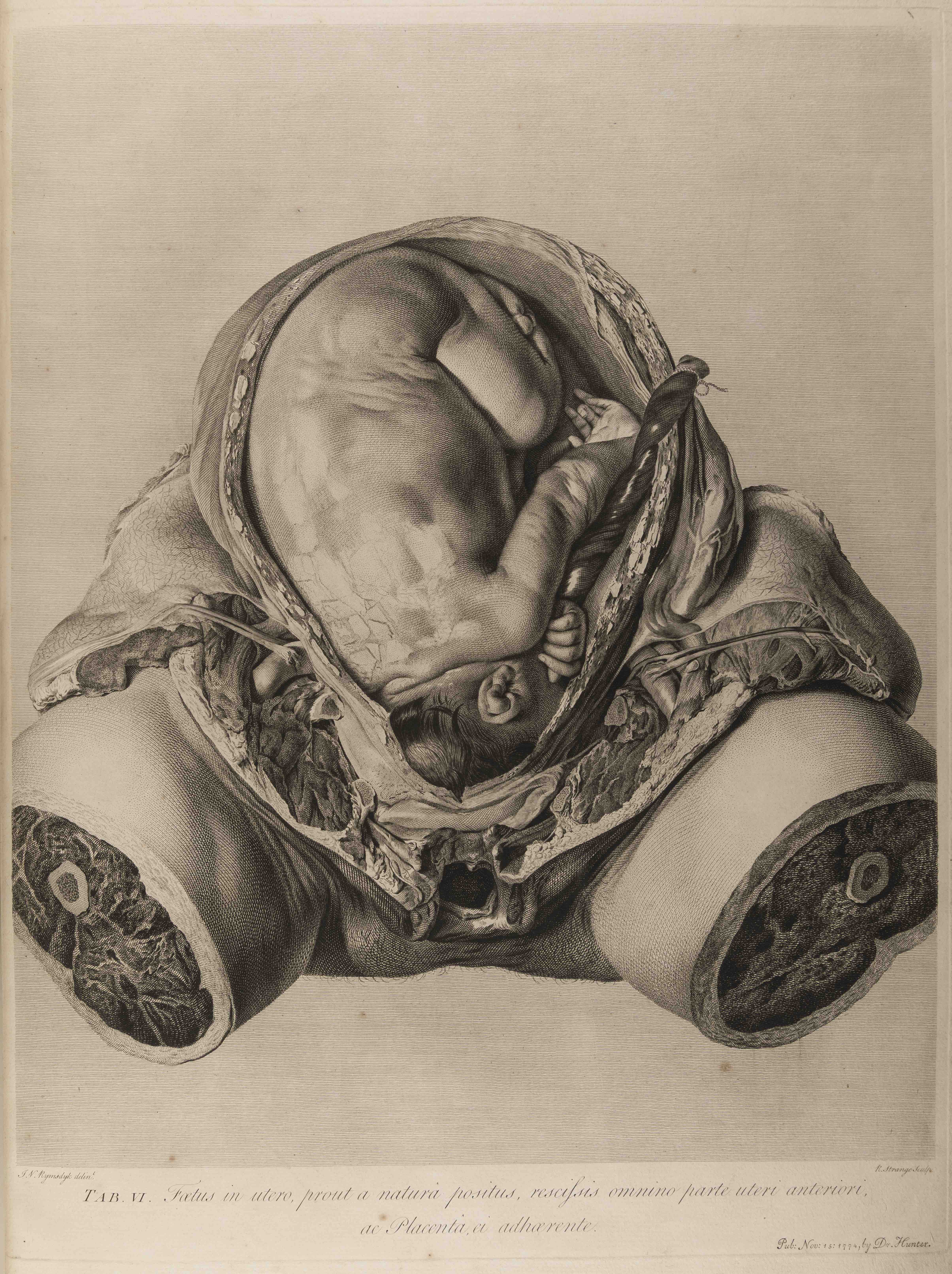 "Table 6 of William Hunter, Anatomia Uteri Humani Gravidi Tabulis Illustrata (Birmingham: John Baskerville, 1774), University of St Andrews Library, rfx QM421.H8."